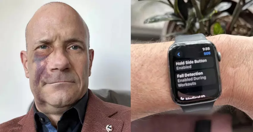 Hoe Apple Watch hielp het leven van een fietser te redden