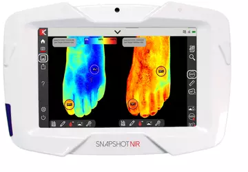 Draagbaar diagnostisch apparaat "Snapshot NIR" ter ...