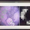Google en het Pentagon hebben een op kunstmatige intelligentie gebaseerde microscoop ontwikkeld voor kankerdiagnose-6 Google en het Pentagon hebben een op kunstmatige intelligentie gebaseerde microscoop ontwikkeld voor kankerdiagnose-6