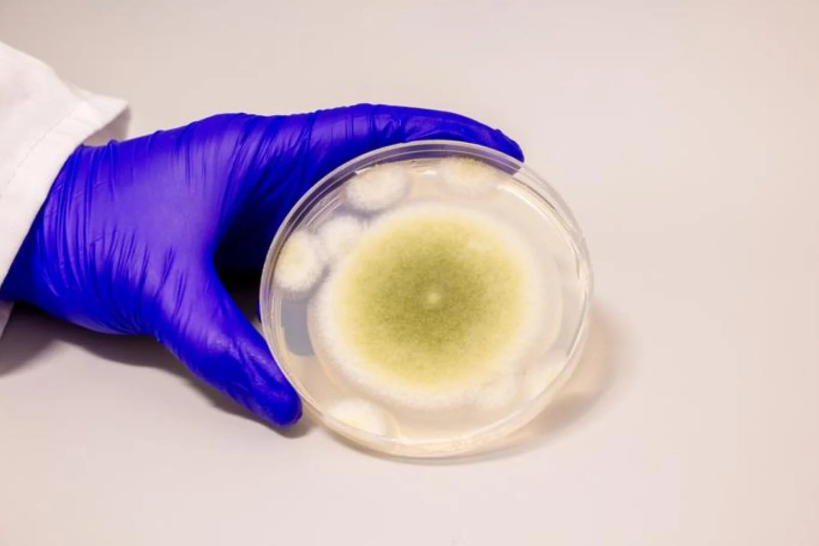 Aspergillus flavus: potentiële innovaties en gezondheidsrisico's Aspergillus flavus: een schimmel met technologische potentieel en uitdagingen