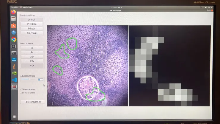 Google en het Pentagon hebben een op kunstmatige intelligentie gebaseerde microscoop ontwikkeld voor kankerdiagnose-3 Google en het Pentagon hebben een op kunstmatige intelligentie gebaseerde microscoop ontwikkeld voor kankerdiagnose-3